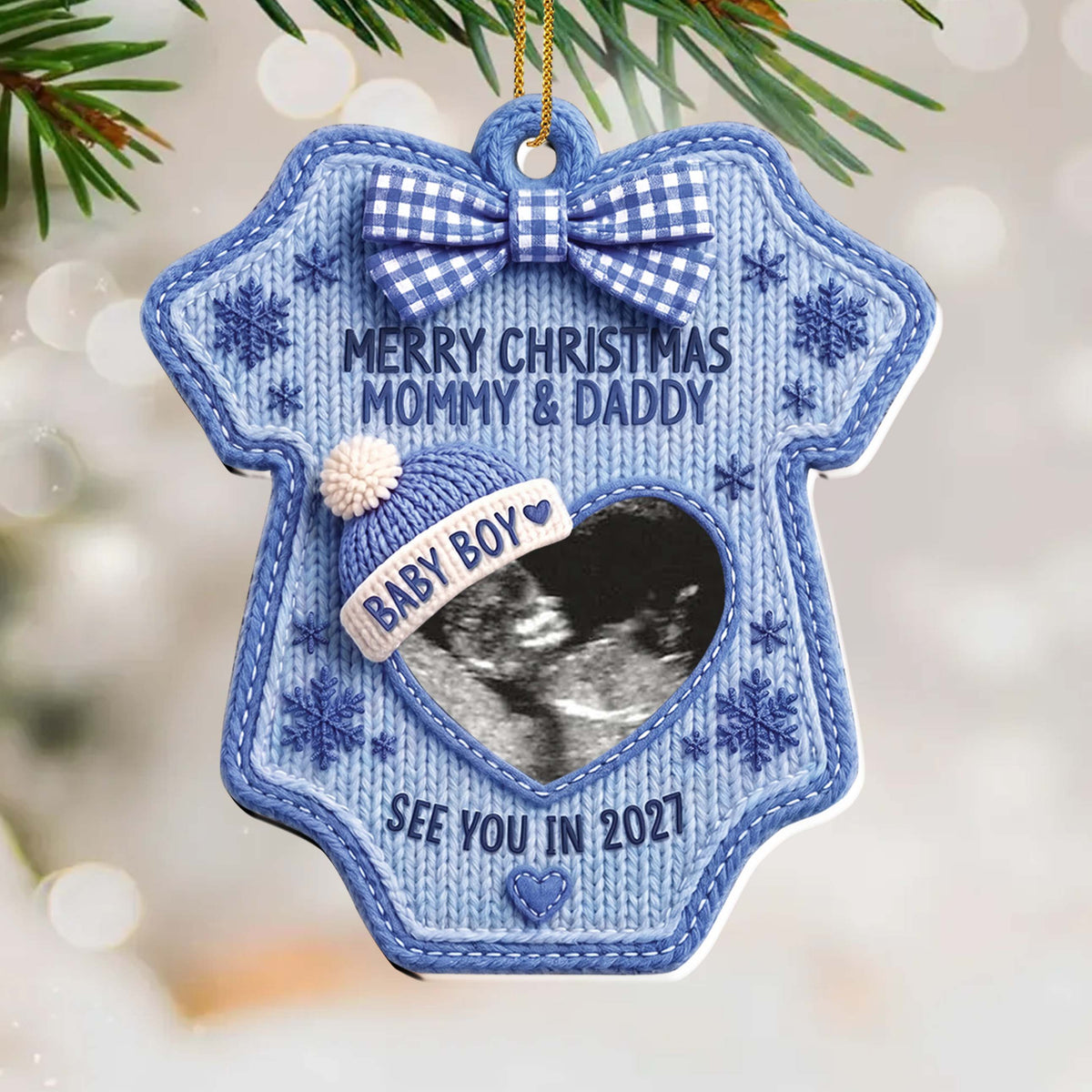 Personalized Ultrasound Photo Christmas Ornament – Baby Bodysuit Design, Custom Acrylic Pregnancy Announcement, Gift for Expecting Parents - XMAS009_ACO